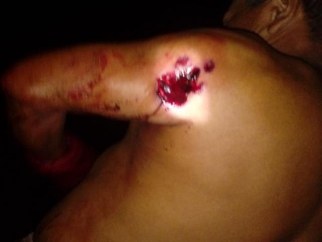 Índio com ferimento no braço; ONG diz que tiro partiu de seguranças, mas sitiantes e polícia negam versão (Foto: Direto das Ruas)