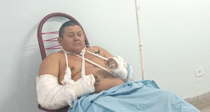 Rodrigo está internado na Santa Casa se recuperando dos ferimentos sofridos durante o ataque (Foto: reprodução / Diário Corumbaense)