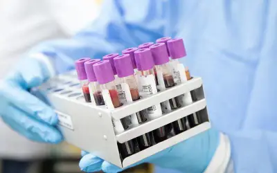 Novo exame de sangue que já chegou ao Brasil pode ajudar no diagnóstico de Alzheimer